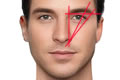 Facial Masculinization Surgery
